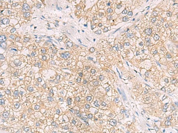 MAPK14 / p38 Antibody