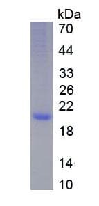 Human Growth Hormone Receptor / GHR Protein (Recombinant 6His, C-terminus)