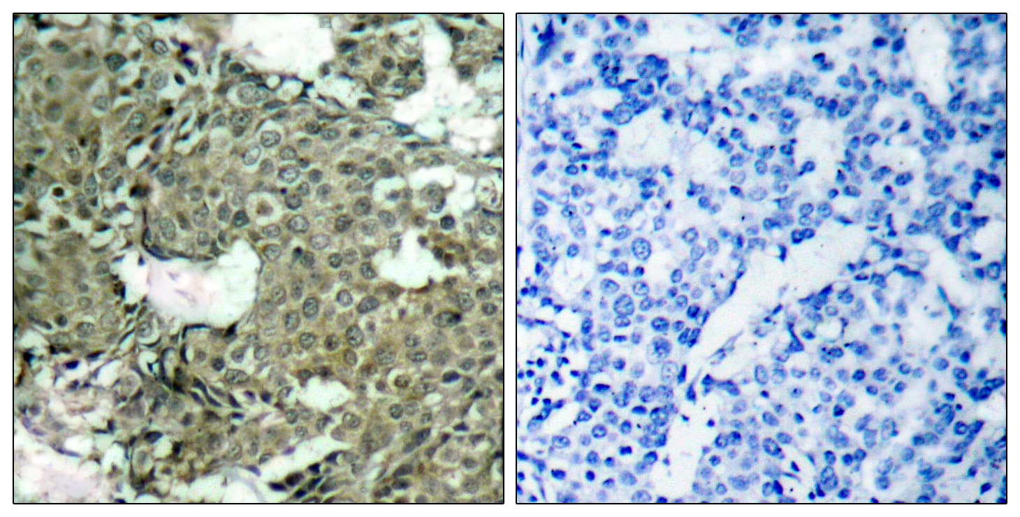 MEK1 + MEK2 Antibody (phospho-Ser221)