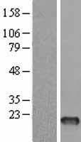 FSHB / FSH Beta Protein (Over-Expression Lysate Myc-DDK (Flag))