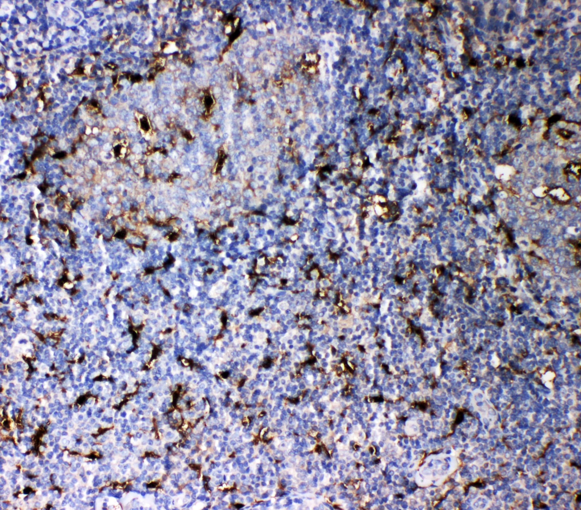 Polyclonal Rabbit anti-Human IL18 Antibody (aa37-193, IHC, WB)