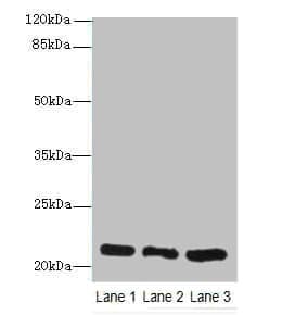 GM2A Antibody
