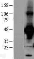 Human RAD9A / RAD9 Protein (Over-Expression Lysate Myc-DDK (Flag))