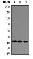 Polyclonal Rabbit anti-Human ACTA1 / Skeletal Muscle Actin Antibody (WB)