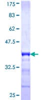 Human TSPAN20 / UPK1B Protein (Recombinant GST, N-terminus)