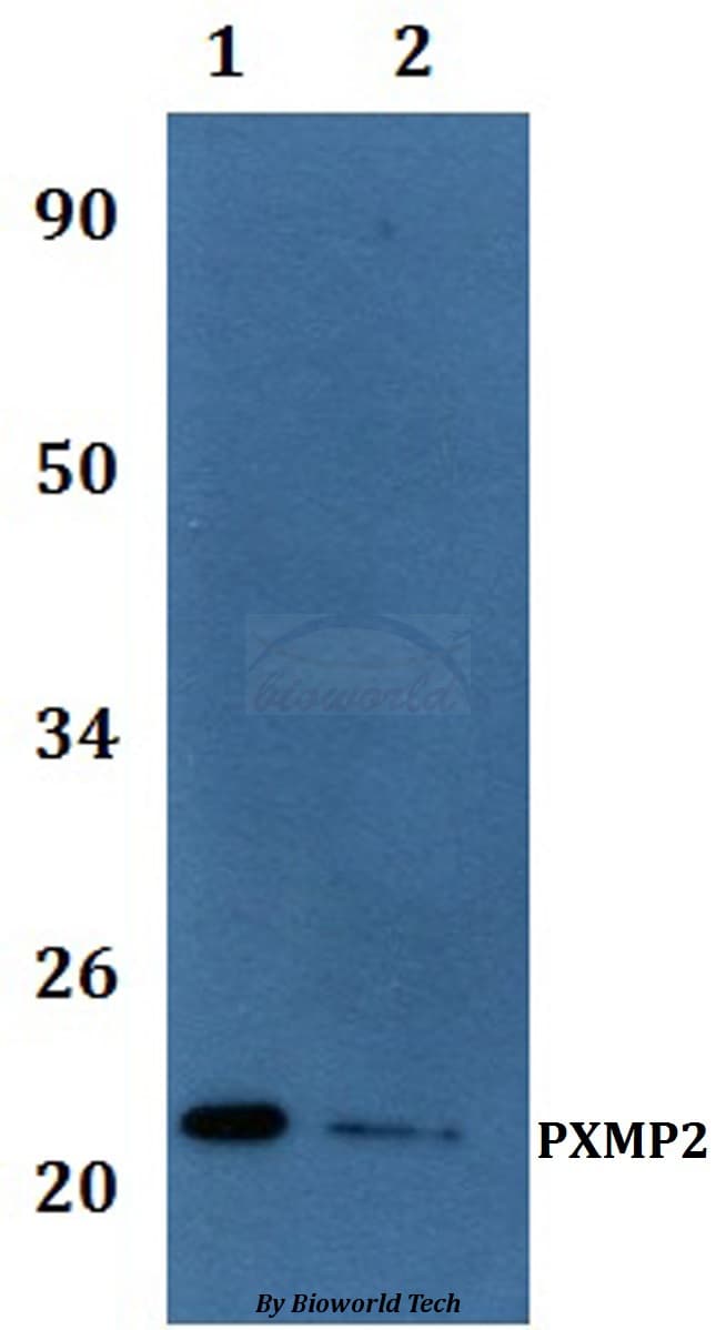 Polyclonal Rabbit anti-Human PXMP2 Antibody (WB)