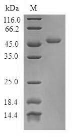 Human TNNC2 Protein (Recombinant GST, N-terminus)