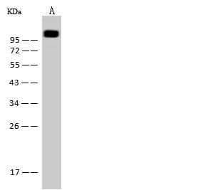 MCAM / CD146 Antibody (clone 281, Preservative Free)