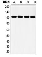 Polyclonal Rabbit anti-Human HDAC7 Antibody (C-Terminus, IHC, WB)