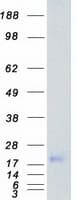 Human MYLK Protein (Recombinant Myc-DDK (Flag))