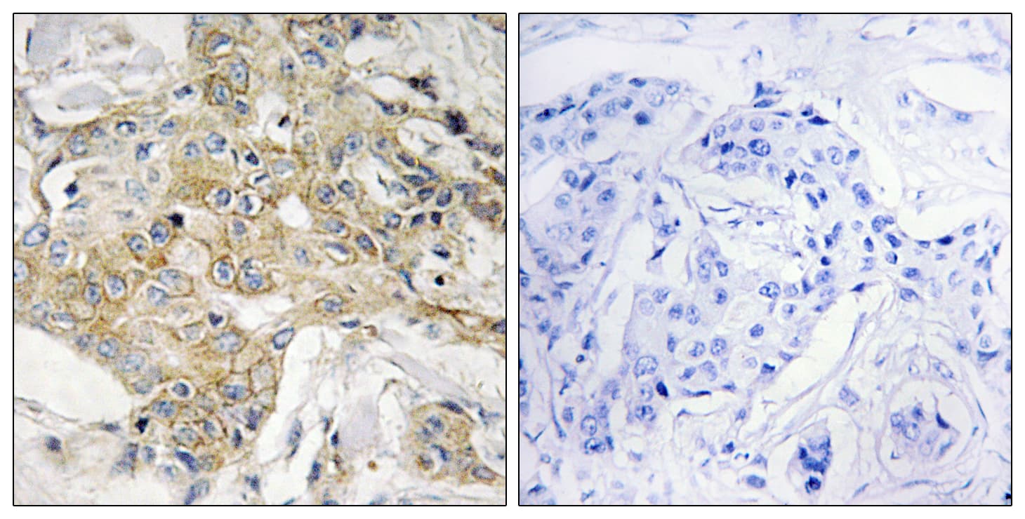 TM4SF1 Antibody (aa1-50)