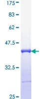 Human IRF5 Protein (Recombinant GST, N-terminus)
