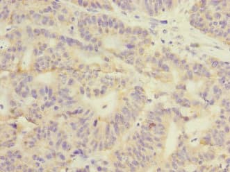 GSTK1 Antibody