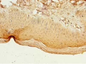 LILRA4 / ILT7 Antibody