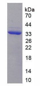Mouse CRP / C-Reactive Protein (Recombinant His-S)