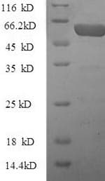 Mouse CTGF Protein (Recombinant GST, N-terminus)