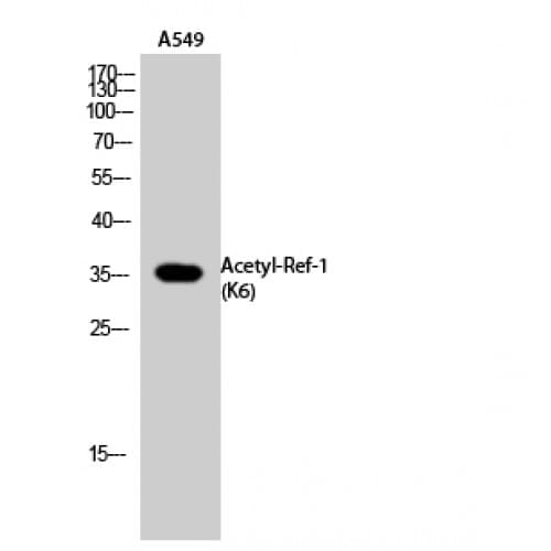 Polyclonal Rabbit anti-Human APEX1 / APE1 Antibody (acetylation site of K6., WB)