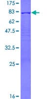 Human PDLIM7 / Enigma Protein (Recombinant GST)