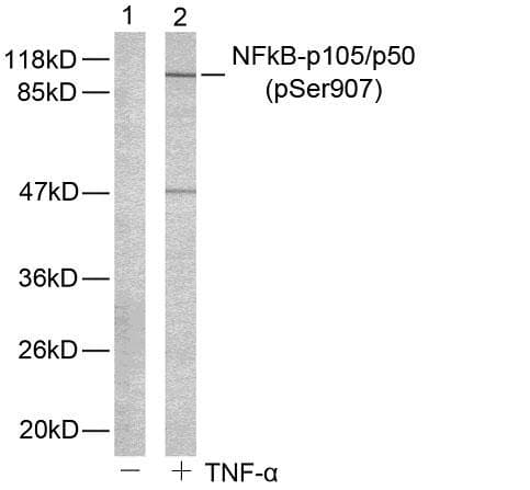 NFKB1 / NF-Kappa-B Antibody (phospho-Ser907)