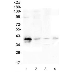 RP2 Antibody