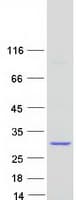 Human KRAS Protein (Recombinant Myc-DDK (Flag))