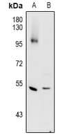 CTSC / Cathepsin C / JP Antibody