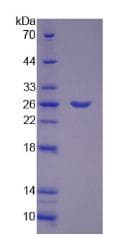 Mouse PYGM Protein (Recombinant His, N-Terminal)