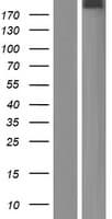 OTOGL Protein (Over-Expression Lysate Myc-DDK (Flag))