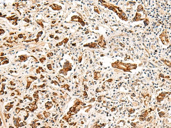 GPR160 Antibody