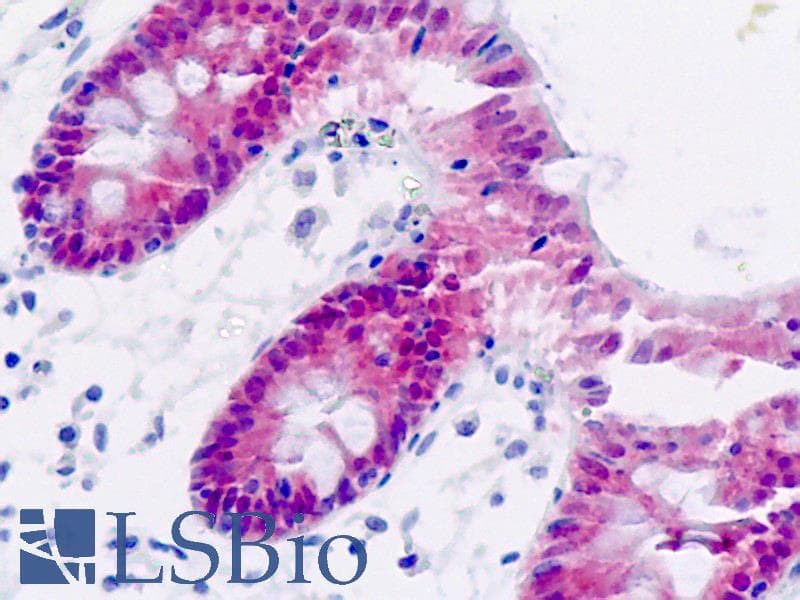IHC-plus™ AKR7A3 Antibody (clone AT2E11)