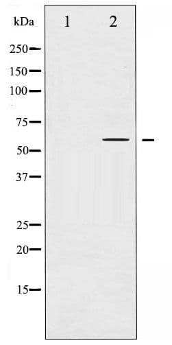 TH / Tyrosine Hydroxylase Antibody (phospho-Ser31)