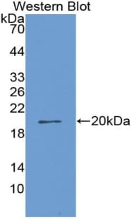 CORIN Antibody (aa334-477)