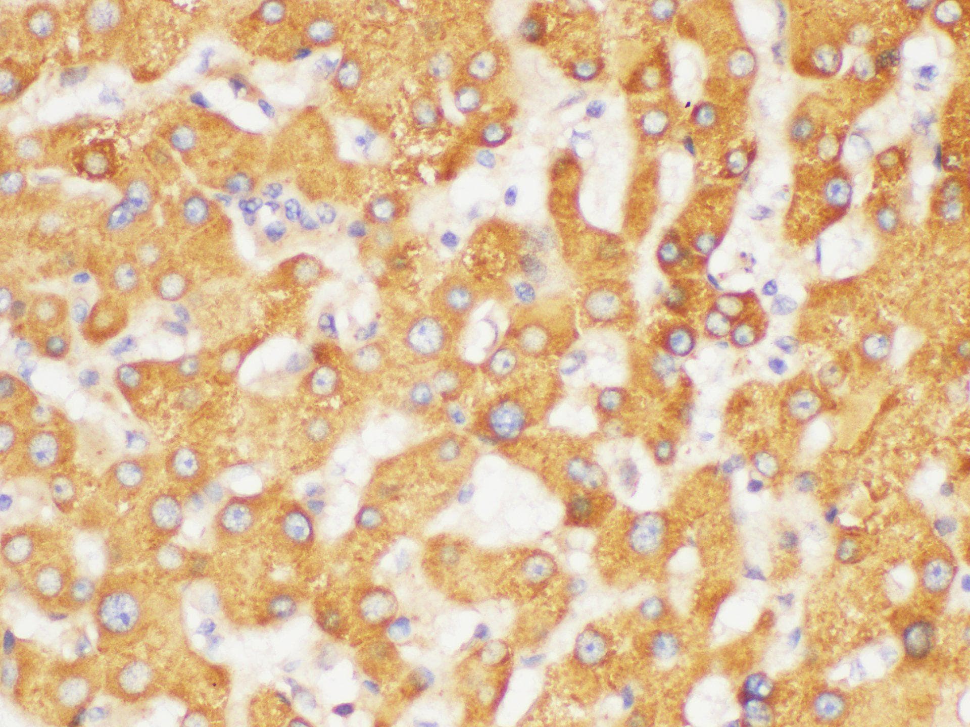 FGB / Fibrinogen Beta Chain Antibody
