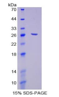 Human ACAN / Aggrecan Protein (Recombinant His, N-Terminal)