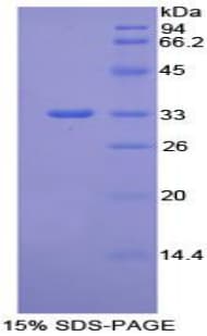 Mouse ITGB1 / Integrin Beta 1 / CD29 Protein (Recombinant His-T7)