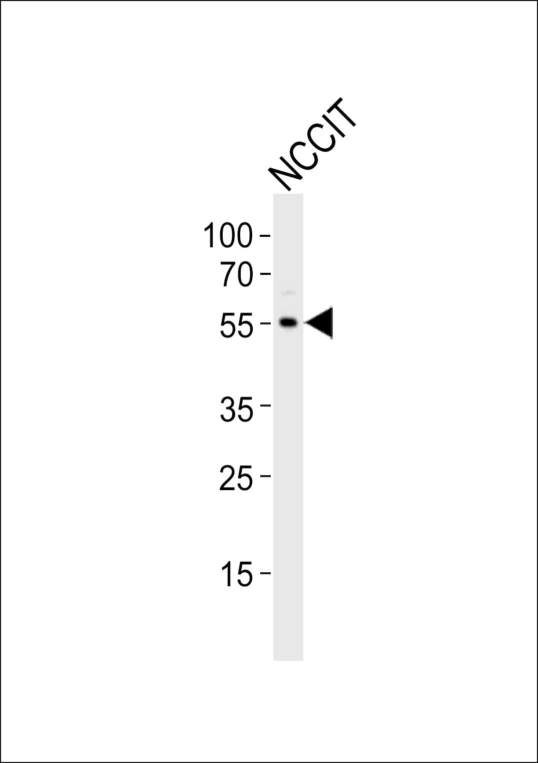 Polyclonal Rabbit anti-Human TRIM60 Antibody (aa177-211, WB)