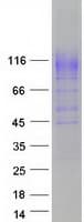 Human SLC12A3 / TSC Protein (Recombinant Myc-DDK (Flag))