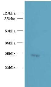 PQLC3 Antibody