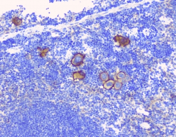 LY9 / CD229 Antibody