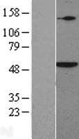 Human SMAD5 Protein (Over-Expression Lysate Myc-DDK (Flag))