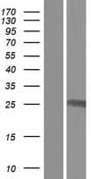 IFT43 / C14orf179 Protein (Over-Expression Lysate Myc-DDK (Flag))