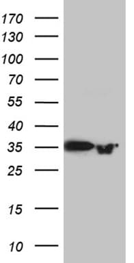 PRPS1L1 Antibody (aa2-318, clone OTI2C6)