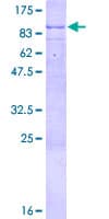 Human TULP2 Protein (Recombinant GST)