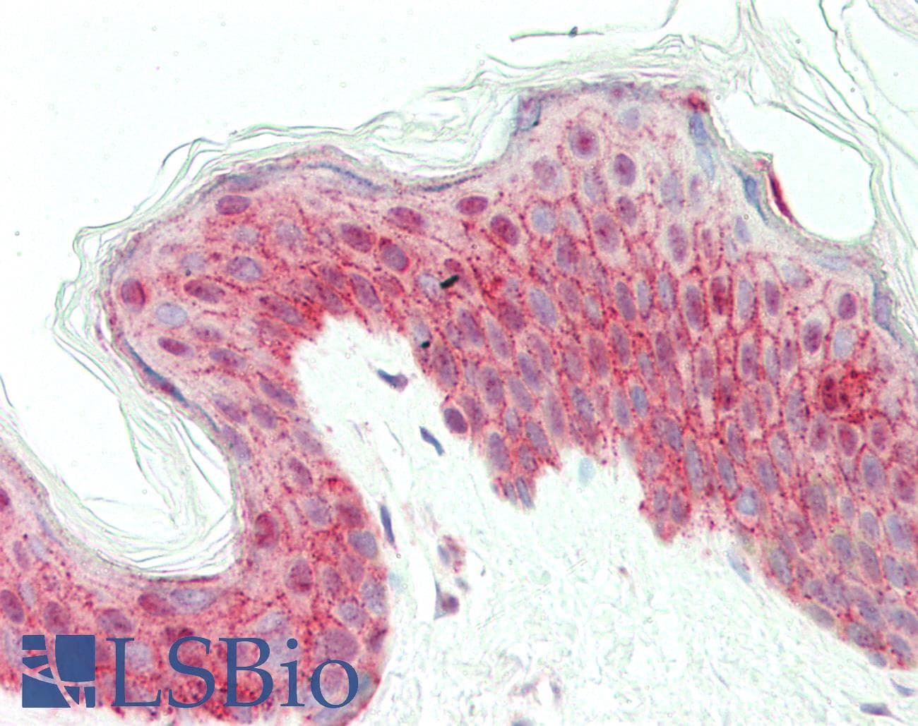 IHC-plus™ Polyclonal Rabbit anti-Human NCOA3 / SRC-3 / AIB1 Antibody (IHC, WB)