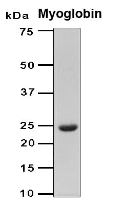 Human MB / Myoglobin Protein (Recombinant 6His, N-terminus)