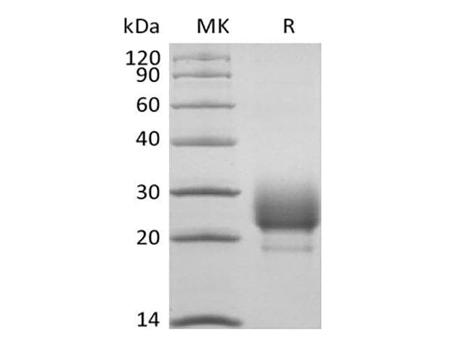 Rhesus monkey CD79B / CD79 Beta Protein (Recombinant 6His, C-terminus)