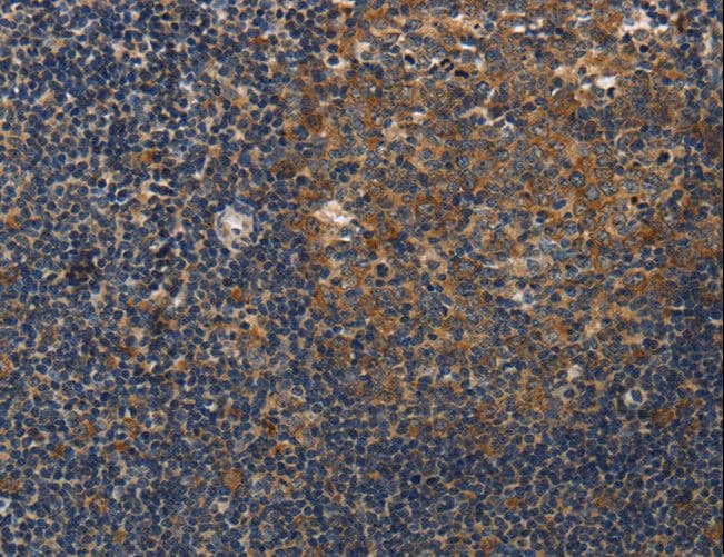 DSP / Desmoplakin Antibody