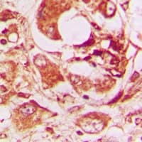 Polyclonal Rabbit anti-Human APG5 / ATG5 Antibody (IHC, WB)