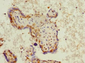 Polyclonal Rabbit anti-Human BCAP / PHF11 Antibody (IHC, WB)