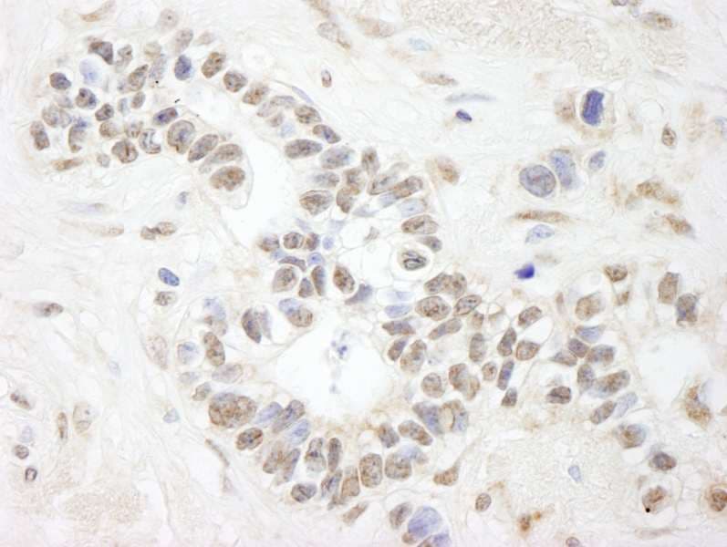 ANKS3 Antibody (aa606-656)